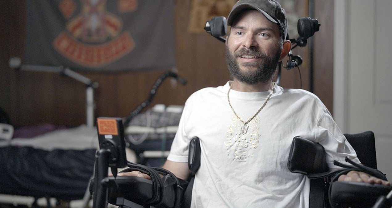 felcli hastalarin umudu mucize cip 12 kisiye yerlestirildi 6kgfNSvd