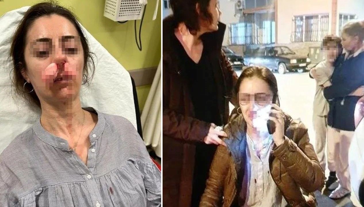 otomobil kapisi silah sayildi esinin sevgilisisandi arabanin kapisiyla saldirdi z6ay3rCw