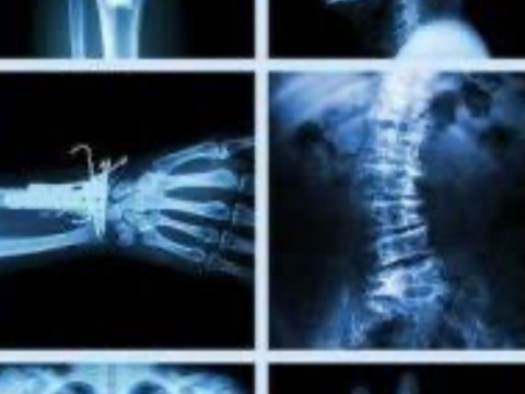 Radyoloji Skandalı İddiaları Üzerine Savcılıktan Soruşturma Başlatıldı: Yanlış Raporlar İnceleniyor